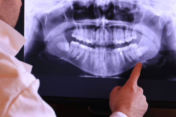 Best Emergency Dental Care for Broken or Chipped Teeth in Springfield, FL